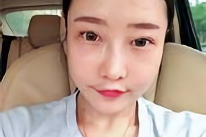 華西口腔醫(yī)院李運峰磨骨手術(shù)價格貴嗎？附價格表和案例