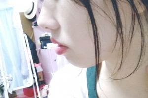 上海中博口腔醫(yī)院劉建勛牙齒矯正果好不好附案例對(duì)比和價(jià)格一覽
