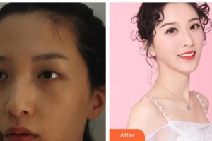 瑞安雅正口腔門(mén)診部孔維展整形價(jià)格表附隱形托槽矯正案例展示