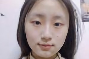 北京圣嘉榮醫(yī)療美容醫(yī)院口碑怎么樣？附案例分享|醫(yī)生推薦