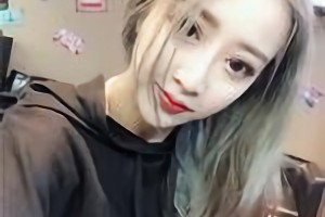 杭州整形醫(yī)院靠譜嗎？附下頜角術(shù)后恢復(fù)過(guò)程圖