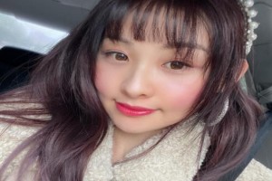 廣州廣大醫(yī)院顴骨內(nèi)推整形果好不好？附案例展示