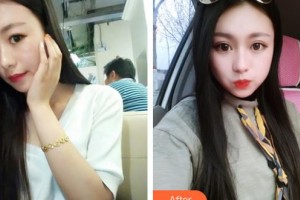 邯鄲市眼科醫(yī)院趙玉霞整形價(jià)格表附切開雙眼皮案例展示