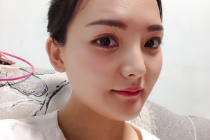 沈陽杏林醫(yī)院整形外科環(huán)境好不好下頜角日記|價(jià)格表