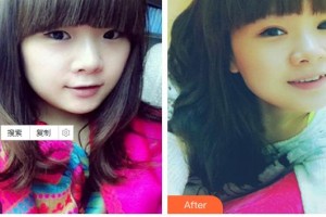 深圳?，斄猪槼毖劭漆t(yī)院施尼可整形價(jià)格表附眼部綜合案例展示
