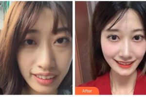 東莞恒生口腔門(mén)診部張帝整形價(jià)格表附牙齒陶瓷矯正案例展示