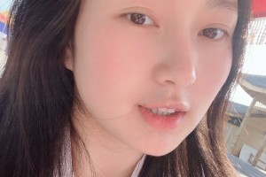 濟寧附屬醫(yī)院整形科下顎角感覺怎樣？真人案例圖片對比