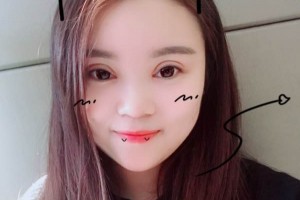 北京中日友好醫(yī)院怎么樣？附雙眼皮手術果圖