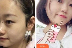 楚雄現(xiàn)代婦產(chǎn)醫(yī)院醫(yī)療美容科賈萬榮整形價格表附微針?biāo)獍咐故?>
</a>
<h3 class=