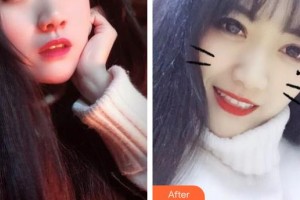 酒泉市口腔醫(yī)院王金禮整形價(jià)格表附美白劑美白牙齒案例展示