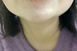 哈爾濱圣安口腔醫(yī)院怎么樣？附牙齒矯正果圖
