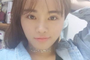 杭州117醫(yī)院整形科主任雙眼皮怎么樣？附果圖展示