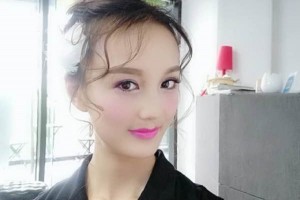 鄭州美立方整形醫(yī)院雙眼皮果好不好？怎么樣？附案例對(duì)比圖
