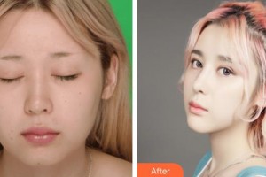 王敢整形價(jià)格表附鼻部綜合案例展示