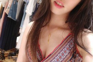 鄭州人民醫(yī)院整形科雙眼皮怎么樣？附手術(shù)果圖及收費(fèi)標(biāo)準(zhǔn)
