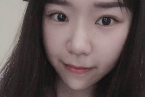 南京中大整形醫(yī)院光子嫩膚好不好？附果圖