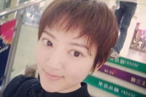 哈爾濱醫(yī)大二院整形美容科雙眼皮？真人案例+醫(yī)生介紹