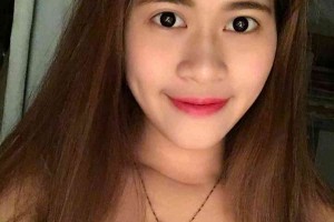 湖南株洲中心醫(yī)院整形科？雙眼皮術后注意事項！