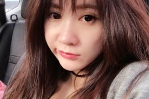 天津一中心整形外科隆鼻怎么樣？真人案例+醫(yī)生介紹