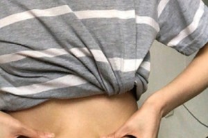 武漢涵美整形醫(yī)院怎么樣？吸脂減肥實拍—術(shù)后恢復