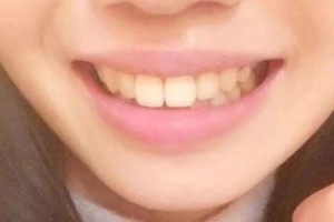 九院正畸科好不好？醫(yī)生名單&2021價(jià)格表
