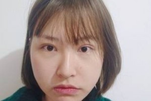麗港醫(yī)療美容整形醫(yī)院怎么樣？醫(yī)生推薦