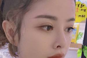 青醫(yī)附院環(huán)境好不好？雙眼皮案例&2021價格表！