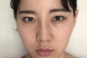 泰安中心醫(yī)院美容科怎么樣/激光祛斑測評點評!