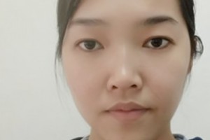廣州新生毛發(fā)醫(yī)院植發(fā)怎么樣？靠譜嗎？2021價格表