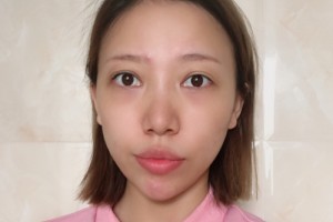 廣州善伊整形口碑如何？醫(yī)生名單+較新費(fèi)用表優(yōu)惠