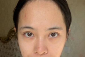 上海九院整形科植發(fā)？掛號(hào)難不難網(wǎng)上掛號(hào)攻略