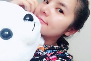 新橋醫(yī)院美容科隆鼻果如何？附術(shù)后圖+價(jià)格表