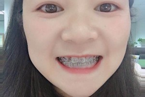 沈陽(yáng)康貝佳口腔牙齒矯正怎么樣/醫(yī)生介紹+名單！