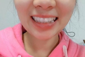 長沙市口腔醫(yī)院牙齒矯正多少錢？案例測評+價格表