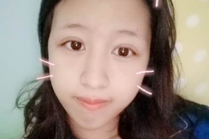 北京愉悅醫(yī)美雙眼皮口碑？醫(yī)院簡(jiǎn)介+案例