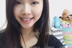 北京拜博口腔醫(yī)院靠譜嗎？附案例圖+價(jià)格表