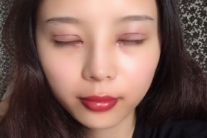 西安星伊美醫(yī)療整形怎么樣？附醫(yī)院簡介+雙眼皮日記