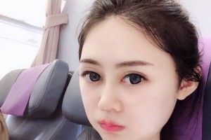 長沙葉子下頜角整形價格表？醫(yī)院介紹+醫(yī)生名單！