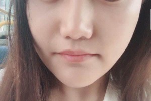 重慶原辰醫(yī)療美容醫(yī)院下頜角怎么樣？醫(yī)生信息介紹