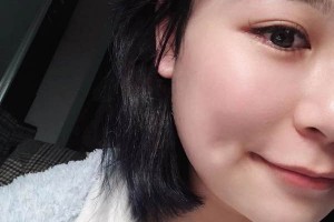 安醫(yī)二附院整形外科下頜角怎么樣？成功案例測(cè)評(píng)！