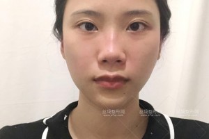杭州浙一醫(yī)院有做熱瑪吉嗎？附果圖+價(jià)格表