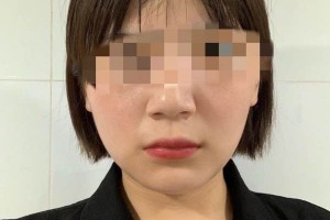 遵義韓美整形醫(yī)院下頜角靠譜嗎？醫(yī)生名單介紹！