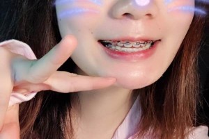 長沙中諾口腔醫(yī)院/牙齒矯正圖片對比！