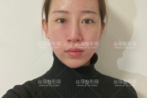 成都軍大美容整形醫(yī)院口口碑好嗎？附醫(yī)院介紹+祛斑果