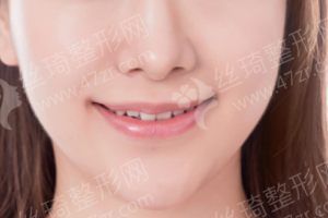 石家莊做牙齒拋光醫(yī)院排行榜醫(yī)院擅長|醫(yī)院詳情,牙齒拋光醫(yī)生術(shù)后案例細節(jié)點評